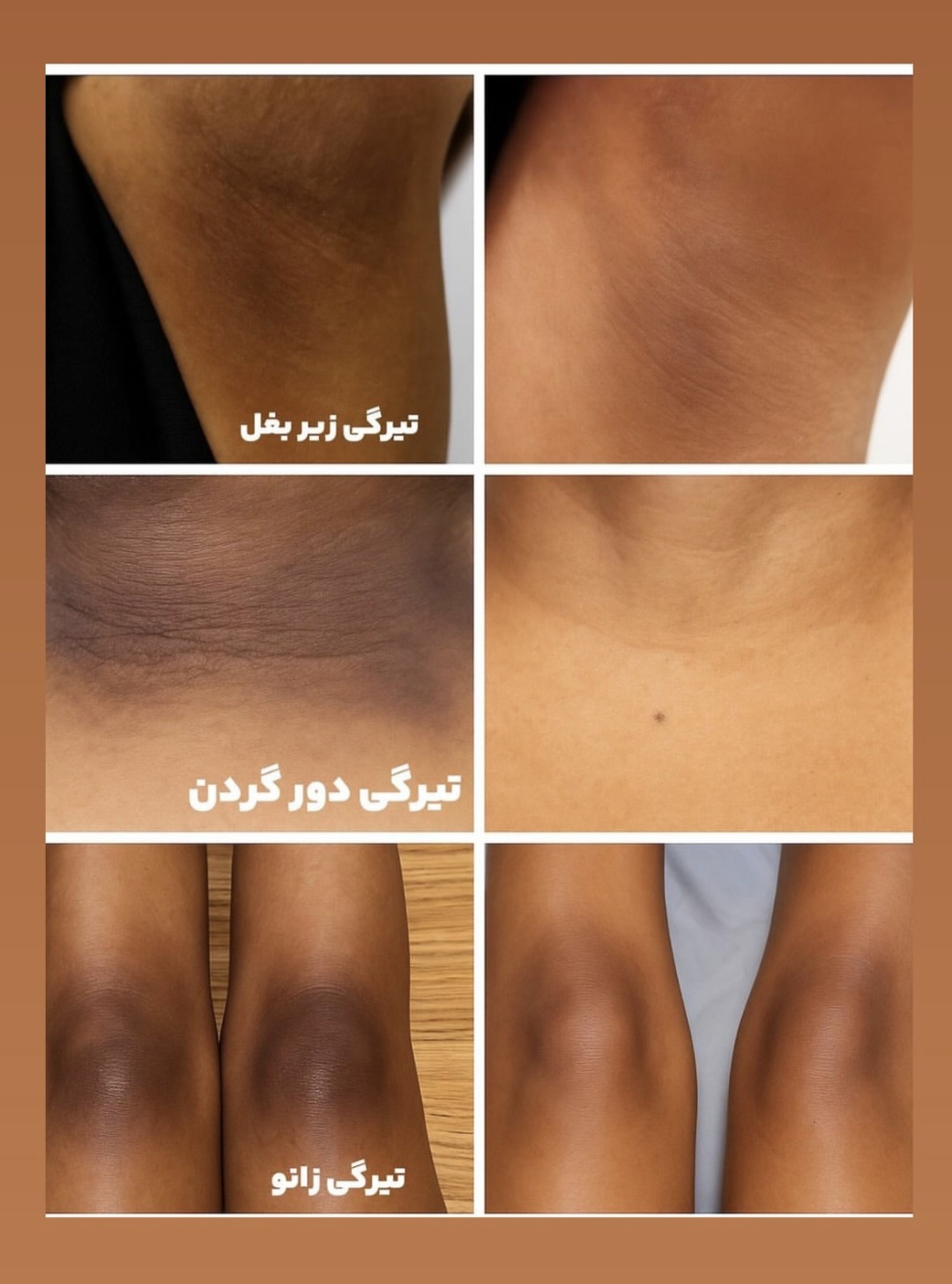 کرم روشن کننده و از بین برنده تیرگی های بدن گاتیو فرانسه