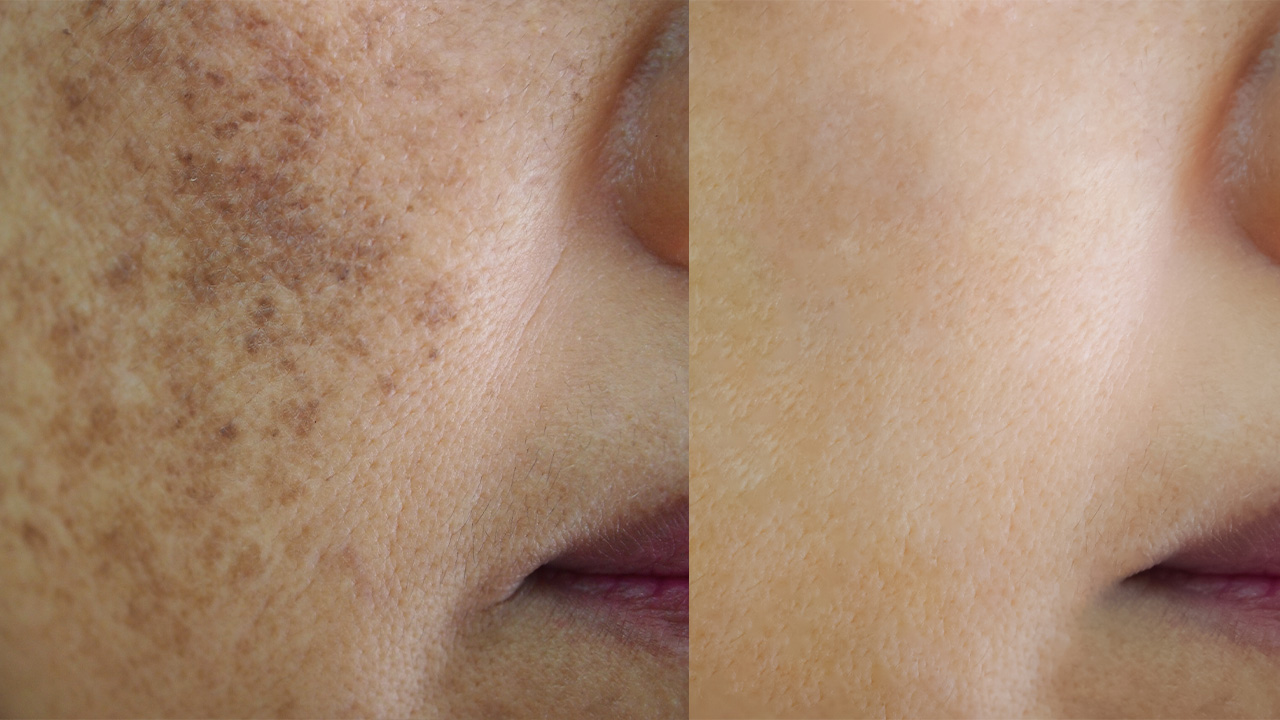 کرم ضدلک و ضدچین وچروک لاکچری کویین