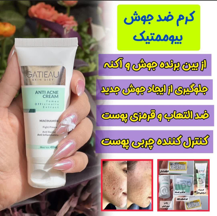پک دو محصوله مناسب ضدجوش و ضدلک گاتیو و لاکچری کوین